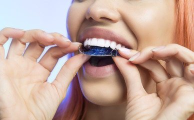 Smiling Girl with Retainer for Teeth, Close-up