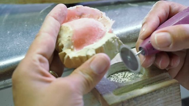 Dental technician removes from cast mold implant teeth.