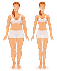 Healthy vs unhealthy people lifestyle infographics vector illustration. Fat slim woman figure icon set. Before after girl body poster isolated white background. Obesity, fitness, diet design element