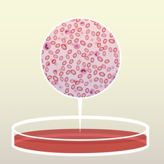 Petri Dish with Blood, Magnified Area  - Vector Illustration - 167247091