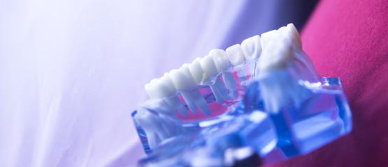 Dentists dental tooth model