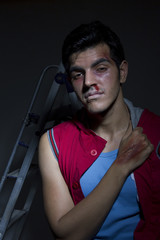 Portrait of unconscious wounded drug addict