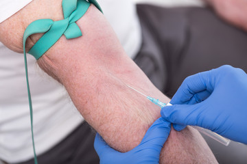 Injection of a catheter in the arm