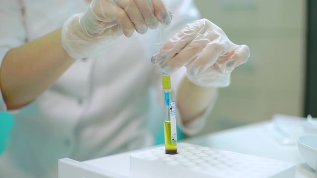 Injection of Plasma into a syringe