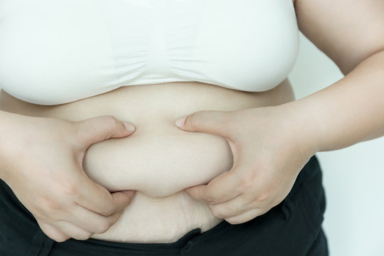 Fat Overweight Woman Pinching Her Fat.