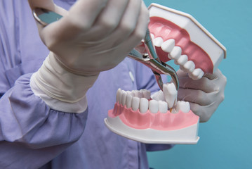 The dental model is used to Demonstration of tooth extraction by doctors. Blue background. - 167449035