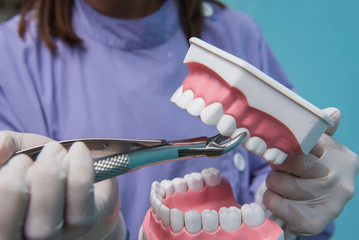 The dental model is used to Demonstration of tooth extraction by doctors. Blue background. - 167449059