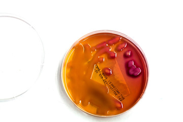 Bacteria in culture media.