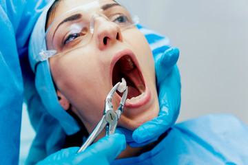 Dentist using surgical pliers to remove a decaying tooth. Modern dental clinic