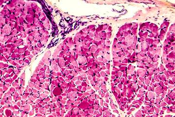 Cross-section of skeletal muscle. Photo under microscope