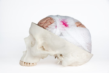 Brain injury model side view on the white background
