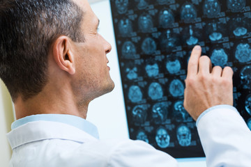 Fototapeta premium Male doctor looking through computer tomography results