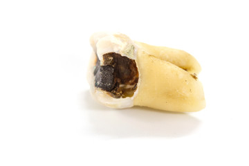 decayed tooth on white background