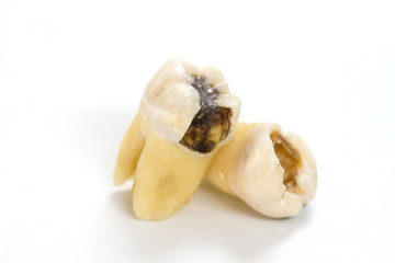 decayed tooth on white background