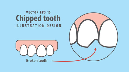 Chipped tooth illustration vector on blue background. Dental concept.