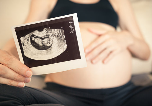 Expecting a baby. Pregnant mother holding ultrasound image