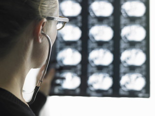 Doctor looking at cancer x-rays