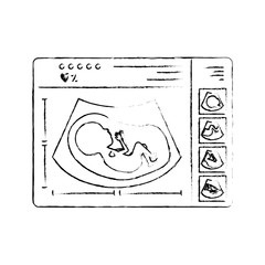 monochrome blurred silhouette of monitoring ultrasound of baby in device