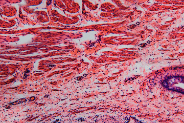 Cell microscopic- bladder of the cat