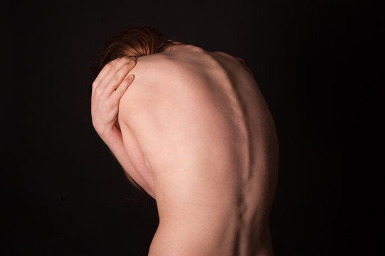 Body part - woman's back, curvature spine