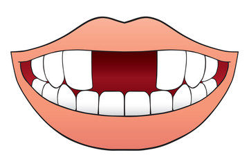 Fototapeta premium Smiling cartoon mouth is missing two front teeth