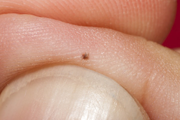Macro picture take off stigma on finger baby