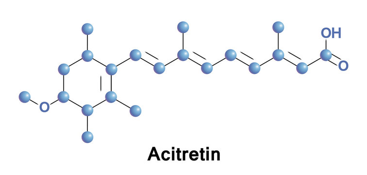 Acitretin Is A Second-generation Retinoid