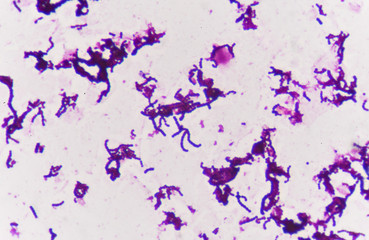 Gram staining, also called Gram's method,.