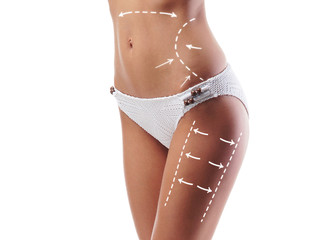 Fat lose, liposuction, sport, fitness, healthy eating, nutrition, fit shape and cellulite removal...