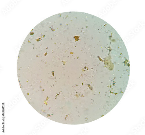 Dead parasites in human stool Dead parasites in human stool