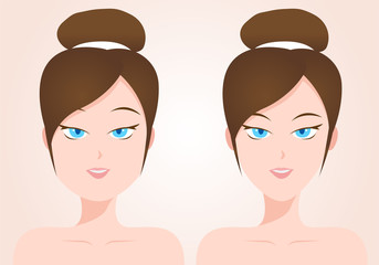 liposuction concept . fat and thin women vector