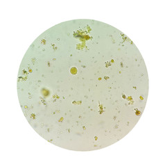 Stool parasites examination test for parasites or eggs in human stool sample with iodine stained under microscope. The parasites are associated with intestinal infections. Clipping path.