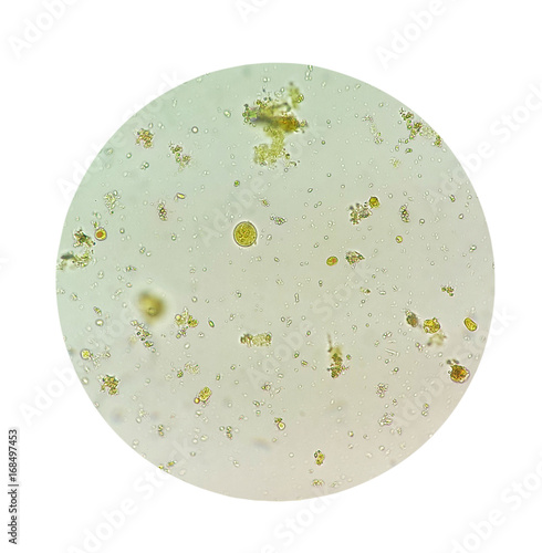 Pictures of parasites in human stool that look like white short string