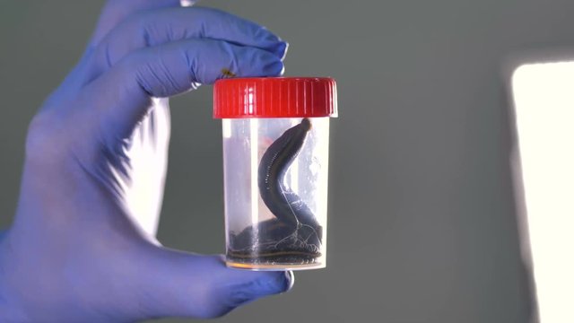 A pair of leeches inside a plastic jar.