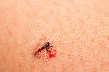 black culex mosquito