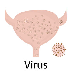 Urinary tract infection. Virus