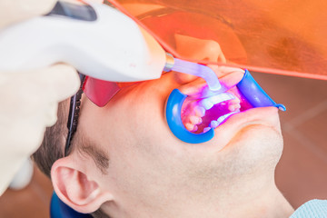 Professional dental treatment, canal filling. Light for polymerization of materials braces Mouth...