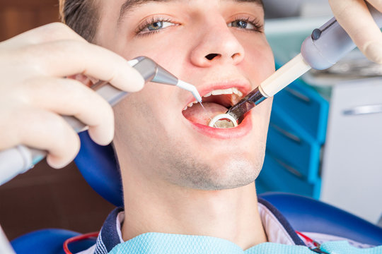 The process of dental treatment. Professional modern equipment for comfortable work. Relaxed young man patient looking to the camera