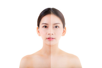 beautiful asian young woman on a white background, beauty concept. retouch before and after.face divided in two parts, poor condition the skin in good condition