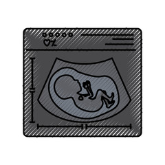 colored crayon silhouette of ultrasound of baby