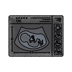 colored crayon silhouette of monitoring ultrasound of baby in device