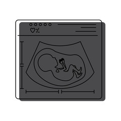 watercolor painted silhouette of ultrasound of baby