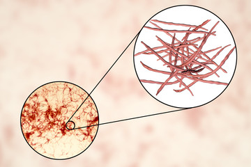 Actinomycetes, gram-positive anaerobic bacteria which resemble fungi, 3D illustration. Actinomyces live in human gums and cause infections in dental procedures, oral abscesses and actinomycosis