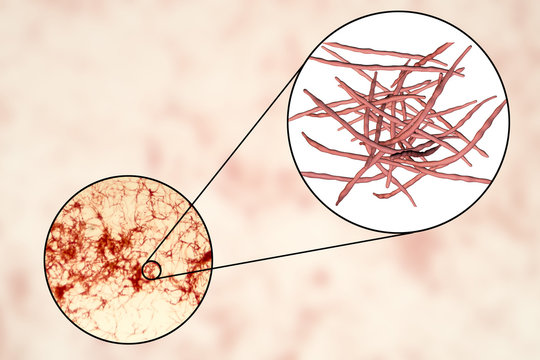 Actinomycetes, gram-positive anaerobic bacteria which resemble fungi, 3D illustration. Actinomyces live in human gums and cause infections in dental procedures, oral abscesses and actinomycosis
