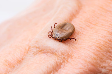 Encephalitis Tick Insect on Skin Macro Close-up