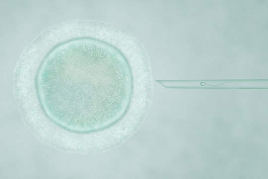 Artificial Insemination by Intracytoplasmic Sperm Injection