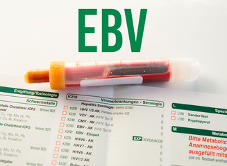 EBV / Blutprobe bei Blutabnahme