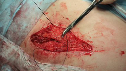 Stitching the wound with surgical wire holden by clamp close-up