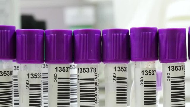 CBC test tube