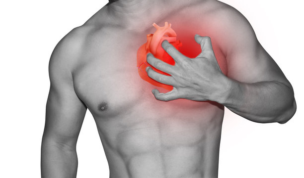 man heart attact